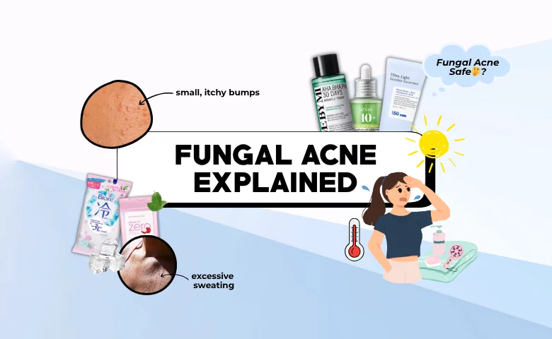 Fungal Acne Explained: Causes, Triggers and Prevention Tips